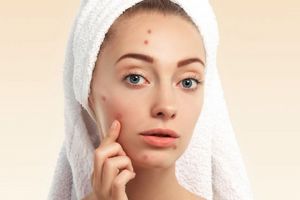 Baunya sering bikin tak nyaman, ternyata ini kandungan pepaya yang ampuh atasi jerawat