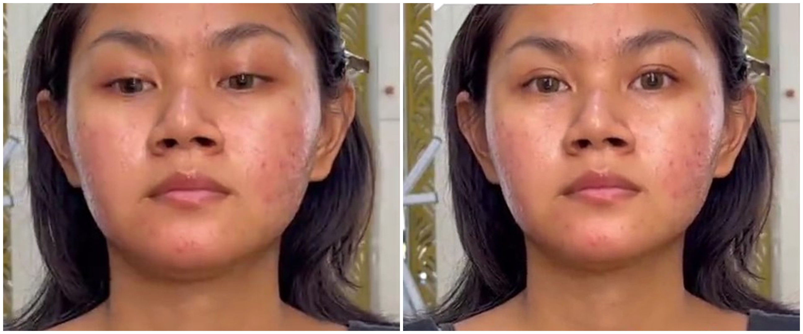 Gadis berkulit sawo matang dan bruntusan dirias MUA ala Korean look ini hasilnya flawless abis