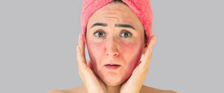 Kulit Terasa Lembap Tetapi Tidak Segar: Apa Yang Perlu Anda Lakukan?