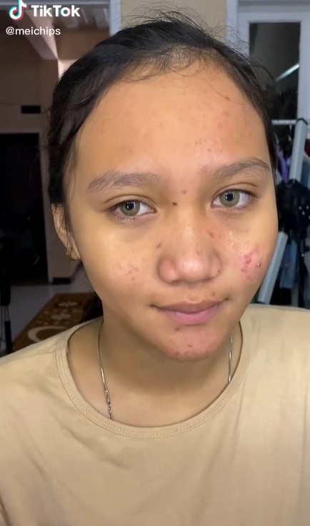 Gadis remaja berjerawat ini dimakeup MUA untuk acara wisuda, hasilnya bak bidadari