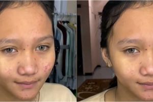 Gadis remaja berjerawat ini dimakeup MUA untuk acara wisuda, hasilnya bak bidadari