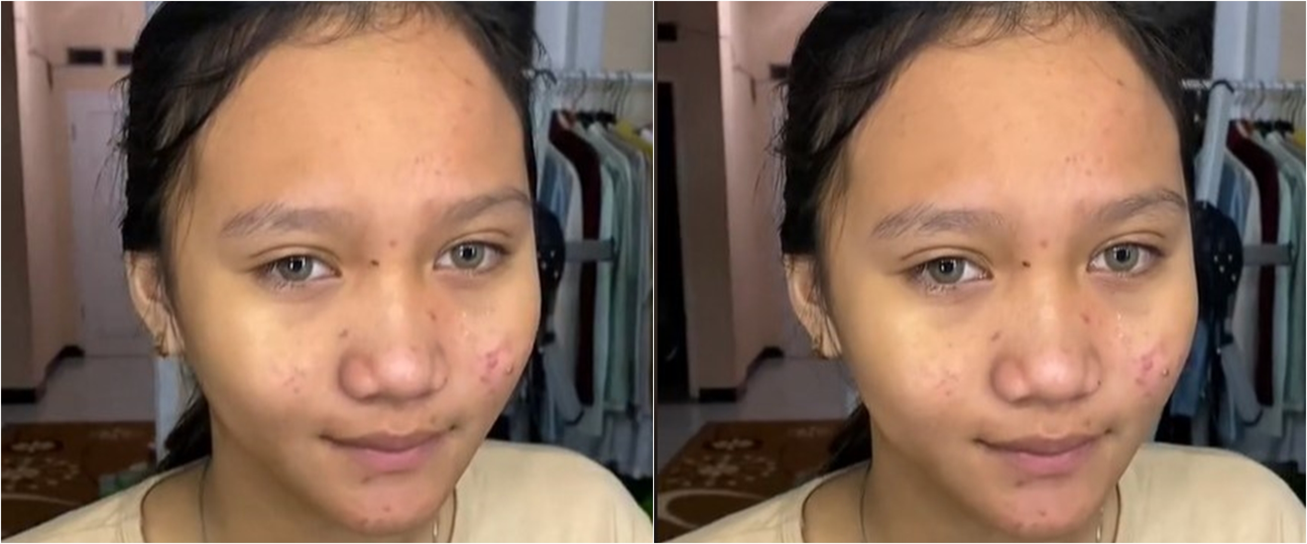 Gadis remaja berjerawat ini dimakeup MUA untuk acara wisuda, hasilnya bak bidadari