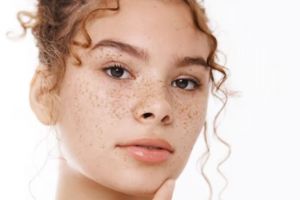 Cuma pakai 1 jenis daun, begini cara memudarkan flek hitam pada wajah secara alami