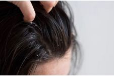 9 Rekomendasi sampo untuk kulit kepala gatal harga mulai Rp 15 ribu, bikin rambut lebih sehat