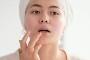 Cuma pakai 1 bahan sayuran, begini atasi bibir kering dan pecah-pecah agar kembali halus