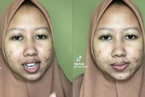 Perubahan wanita usai makeup sendiri ini bikin takjub, bekas jerawat autohilang dan mulus tanpa celah