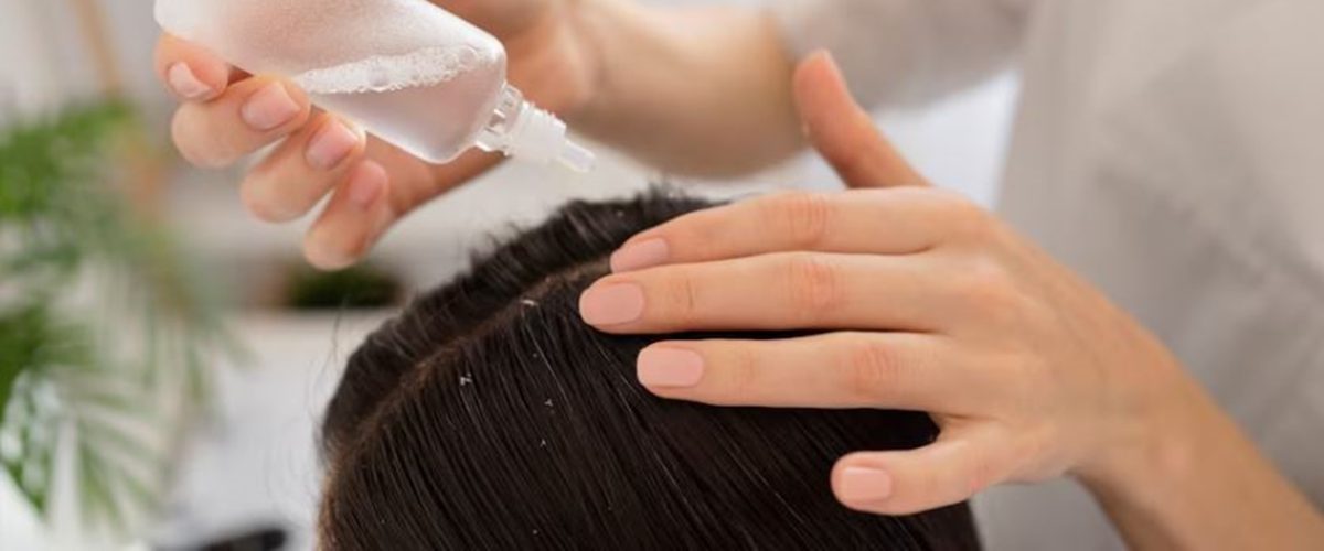 Bantu atasi rambut kering dan botak, begini trik membuat hair ton