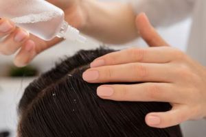Bantu atasi rambut kering dan botak, begini trik membuat hair tonic sendiri hanya pakai 1 bumbu dapur