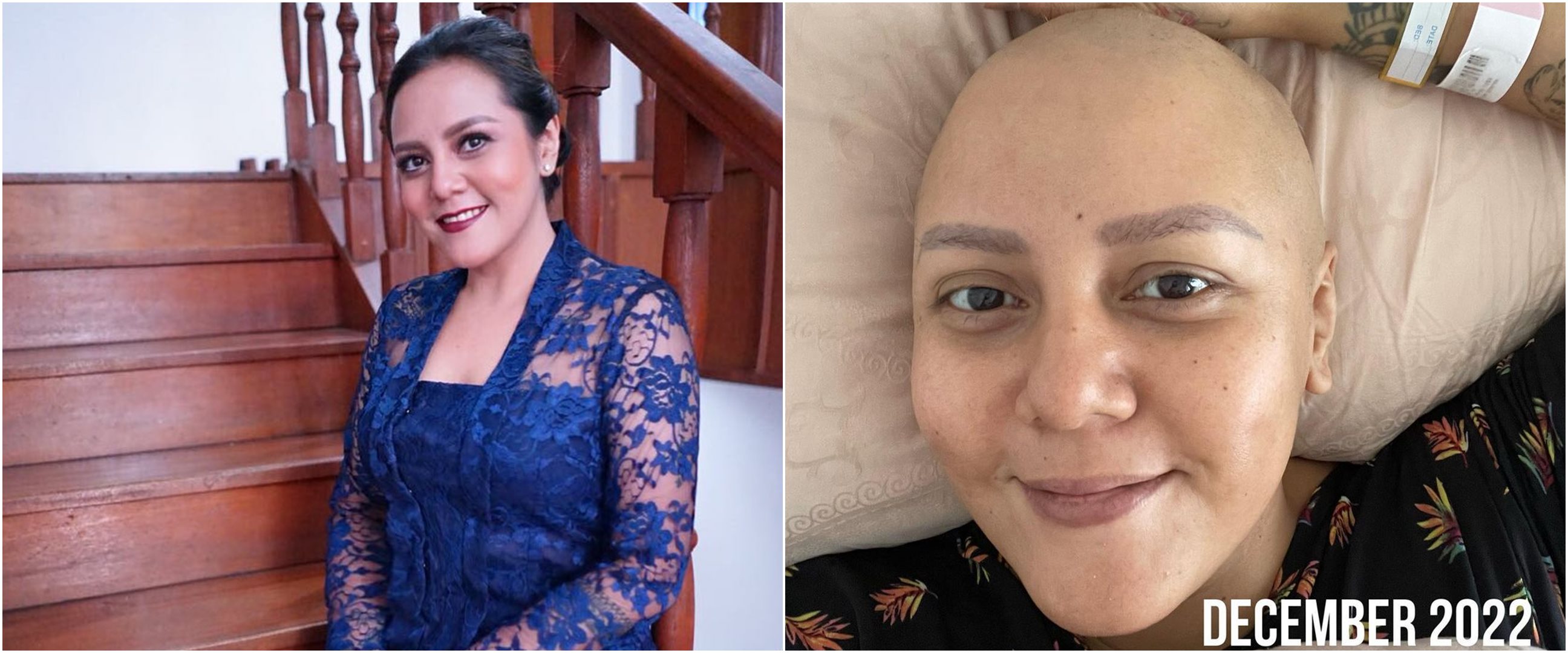 Kini tampil dengan kepala plontos, Cinta Ramlan ceritakan perjuangan hidup usai divonis kanker serviks