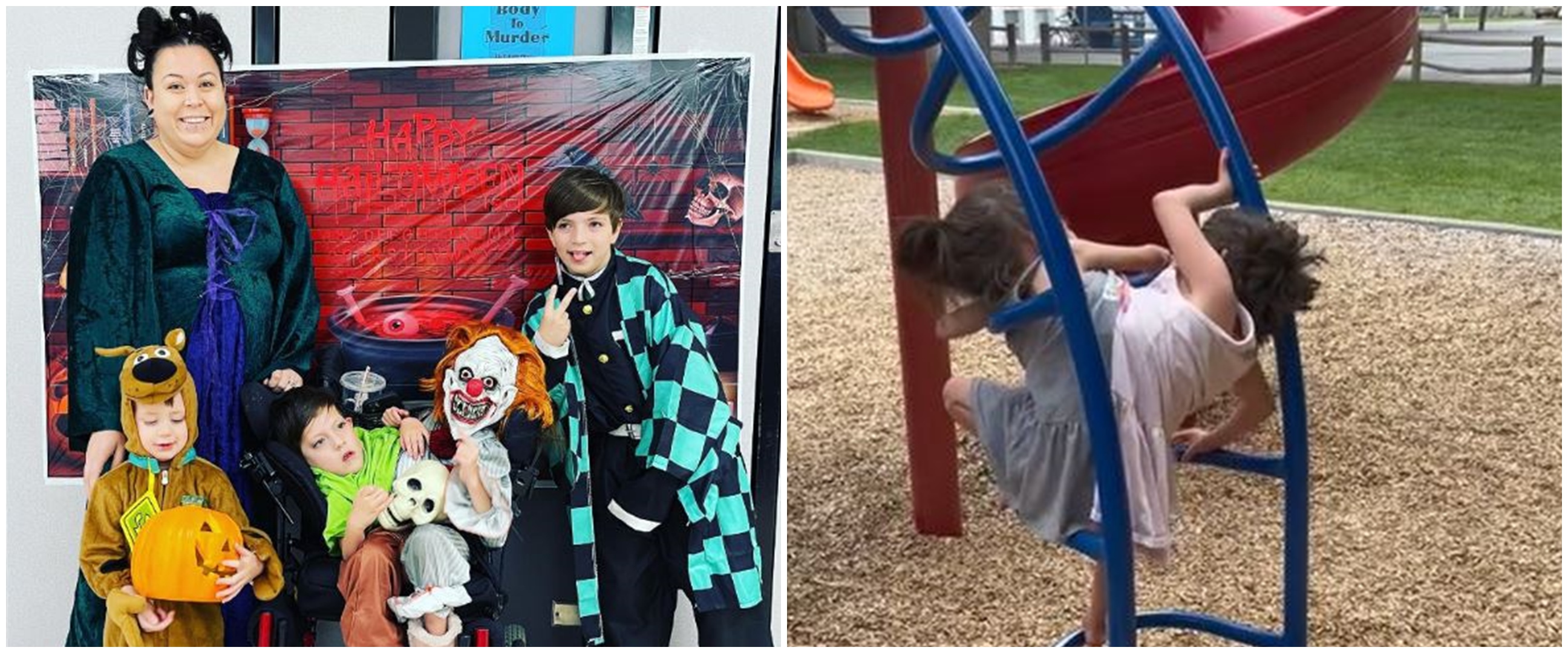 Kisah heroik ibu beranak kembar siam ini bikin salut, sempat ingin digugurkan dokter tapi ditolak