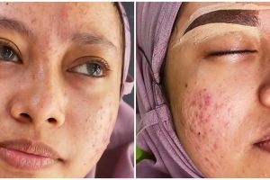 Skill makeup diuji, MUA ini berhasil bikin kliennya yang sedang breakout jadi manglingi