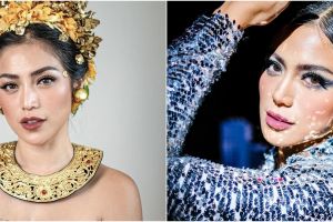 Jessica Iskandar disebut mirip Lucinta Luna usai operasi hidung, potret terbarunya bikin pangling