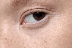 Hanya pakai 1 buah, begini cara atasi bintik hitam pada wajah agar kembali cerah