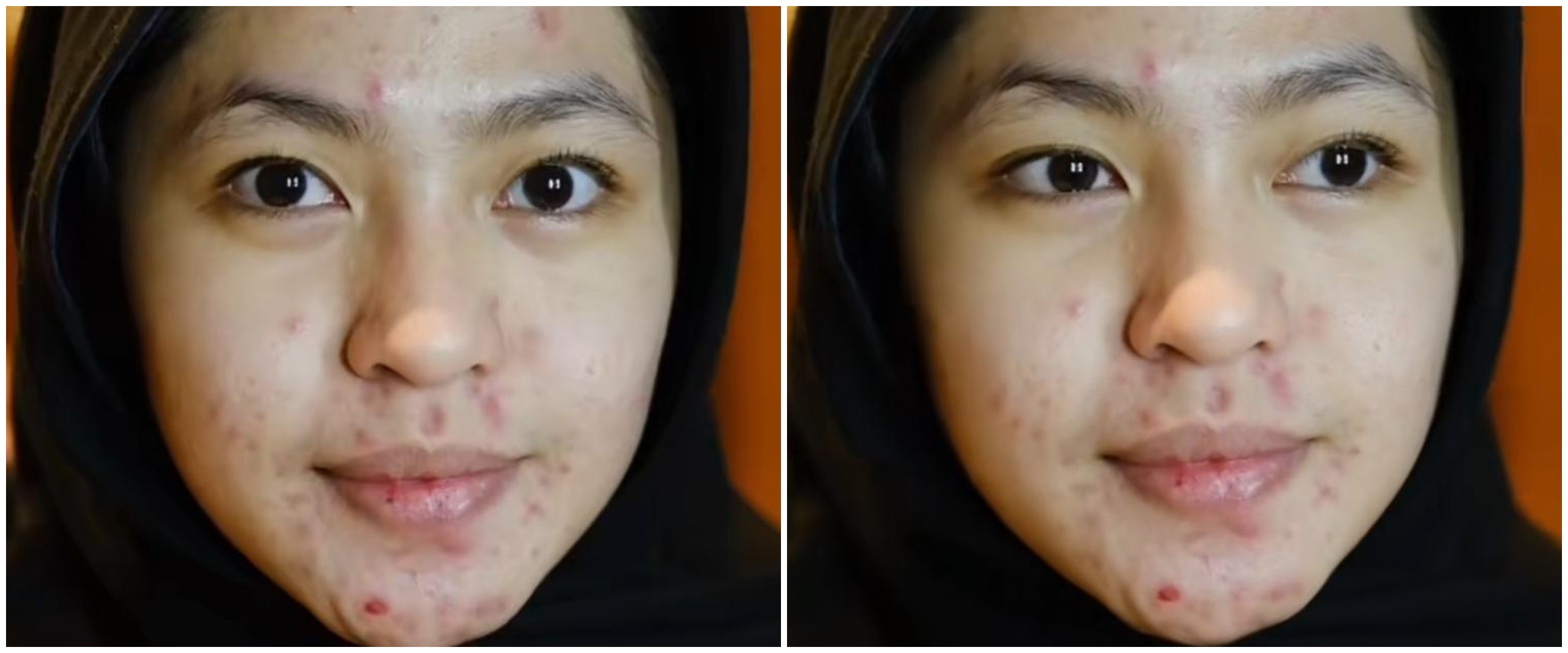 Wanita berjerawat ini dirias MUA jadi pengantin dengan siger Sunda, hasil makeupnya manglingi