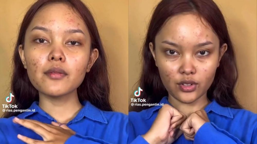 Wanita penuh bekas jerawat ini dimakeup ala Jisoo BLACKPINK di video klip Flower, hasilnya bikin kagum