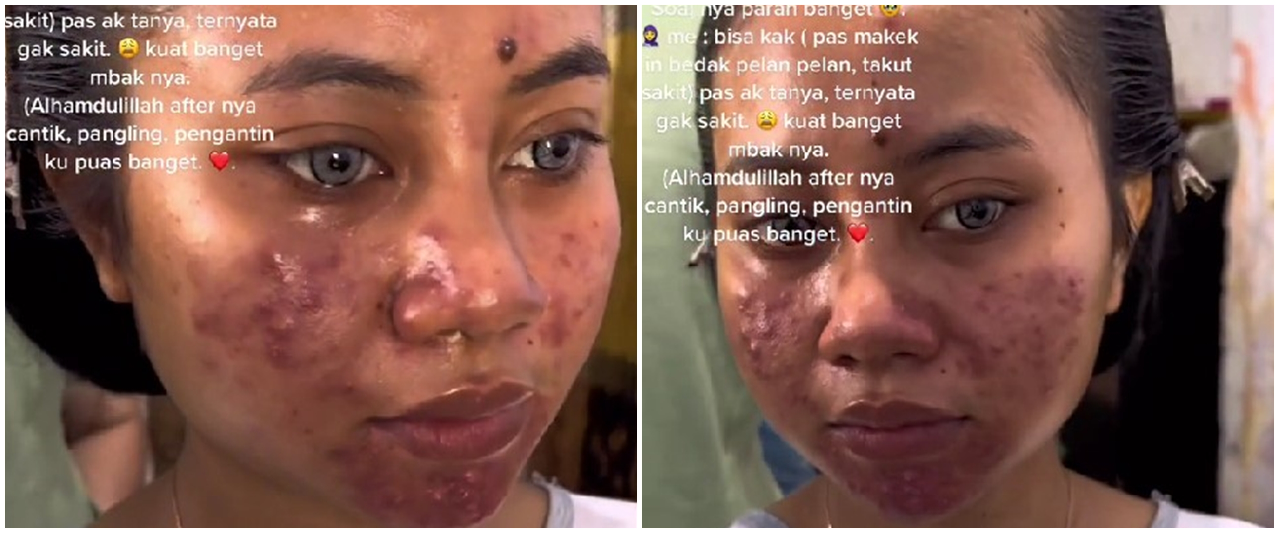 Pengantin berjerawat tampak mulus dan glowing usai dirias MUA ini bikin pangling, disebut mirip Barbie