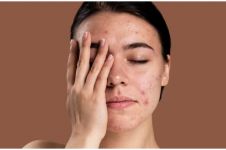 9 Rekomendasi serum untuk memperkuat skin barrier mulai Rp 60 ribu, hilangkan kemerahan dan iritasi