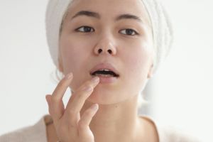Bukan dikelupas, ini 7 cara mengatasi bibir kering karena sunburn