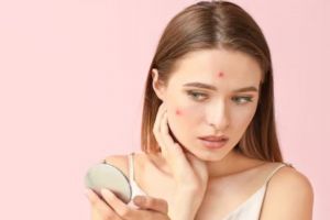 Wajah mulus dan cerah, ini cara membuat masker untuk cegah munculnya jerawat pakai 2 bahan dapur