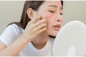 Hilangkan kemerahan di wajah, ini 9 bahan alami untuk mengatasi kulit sensitif