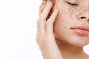 Cara hilangkan noda hitam pada wajah pakai masker dari 1 jenis tanah, bikin kulit cerah dan bersih