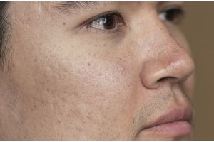 Trik hilangkan flek hitam hanya pakai 1 jenis lalapan ini bikin wajah auto glowing