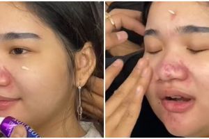 Transformasi cewek dengan kulit breakout dirias MUA untuk acara wisuda, hasilnya manglingi 