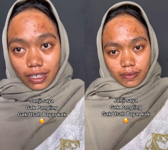 Transformasi wanita berjerawat dirias MUA jadi pengantin sunda, hasilnya dipuji mirip Lesty Kejora