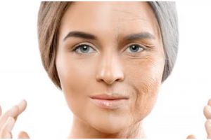 Trik samarkan flek hitam hanya pakai masker dari 2 bahan makanan, bikin kulit kembali cerah