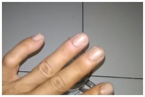 Tanpa jarum atau air hangat, ini trik mengeluarkan duri ikan di tangan pakai 1 bahan dapur