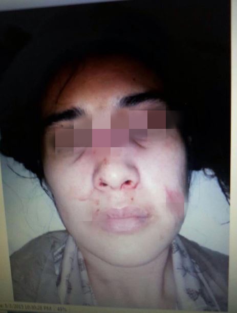 Jadi korban KDRT, wanita asal Depok ini curhat malah jadi tersangka dan ditahan polisi