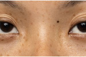 Wajah 10 tahun tampak muda, ini trik cegah bintik hitam di wajah hanya pakai masker dari 1 jenis buah