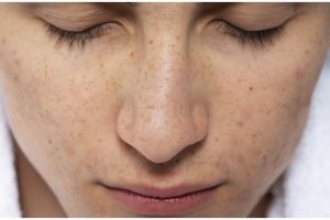 Trik hilangkan flek hitam di wajah hanya pakai face wash dari 1 sayuran ini bikin auto glowing