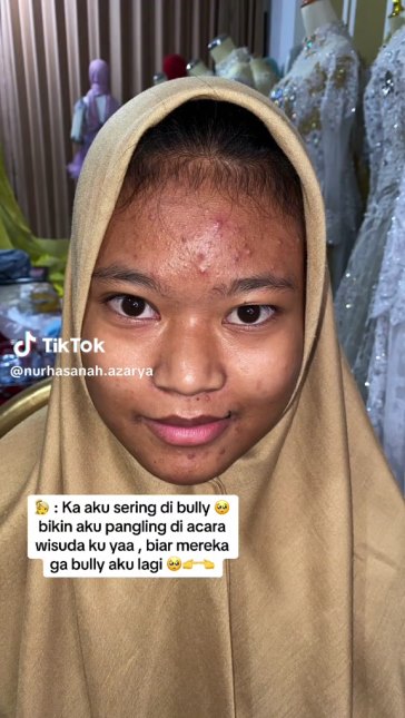 Sering dirundung karena wajah berjerawat, MUA rias wajah wanita ini jadi manglingi di acara wisuda