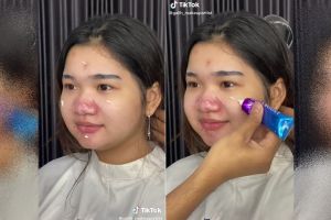 Hidung merah bak badut akibat jerawat, potret wanita chubby dirias MUA ini bikin wajah jadi mulus pol