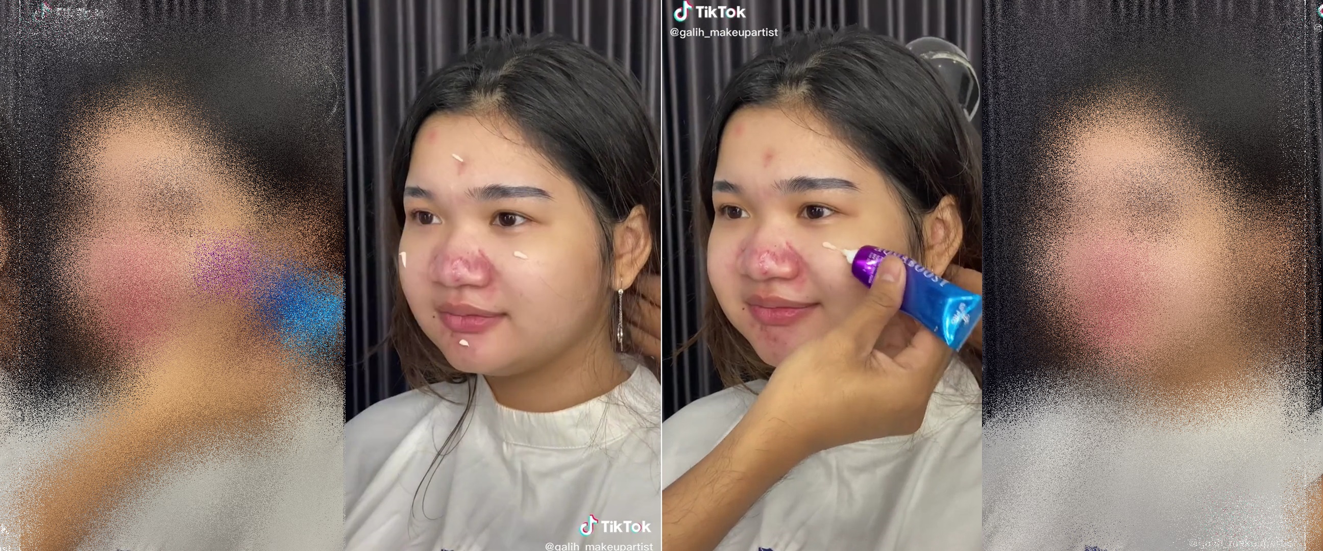 Hidung merah bak badut akibat jerawat, potret wanita chubby dirias MUA ini bikin wajah jadi mulus pol