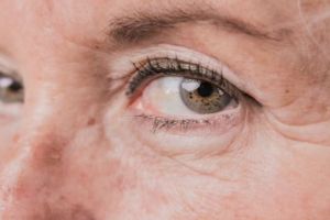 Bukan pakai eye patch, begini cara mengencangkan keriput area mata pakai serum dari 1 bahan minuman