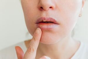 Hanya pakai 3 bahan makanan, begini trik mencerahkan bibir kasar dan kering agar tampak plumpy