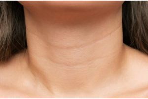 Kulit auto kencang dan halus, begini cara kurangi garis halus di leher hanya pakai 1 bahan sayuran