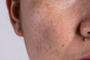 Cara mengatasi pigmentasi dan keriput pada kulit pakai scrub kolagen dari 1 jenis biji, auto awet muda