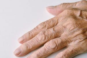 Antikeriput dan bebas hiperpigmentasi, begini trik atasi penuaan pada tangan pakai 1 jenis rempah