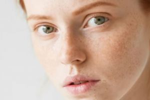 Wajah auto mulus, begini cara mengatasi bintik hitam akibat pigmentasi pakai masker dari 3 bahan alami