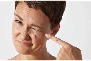 Cara pudarkan flek hitam di pipi pakai serum ceramide dari 1 bahan makanan, bikin kulit kembali cerah