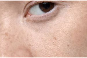 Kulit kembali cerah dan merata, begini trik samarkan melasma di wajah hanya pakai 2 jenis buah