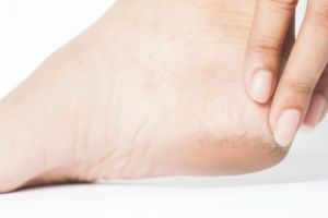 Antikasar dan bebas kapalan, ini trik menghaluskan tumit pecah-pecah pakai 2 jenis minyak