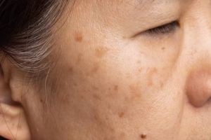 Lawan penuaan dan kulit belang, ini cara simpel gunakan 1 jenis buah agar wajah jadi cerah berseri