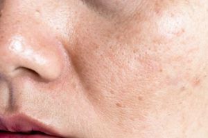 Wajah kenyal dan awet muda, ini cara mengatasi kerutan dan flek hitam pakai 1 jenis buah