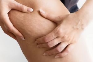 Kulit jadi mulus dan cerah, ini cara menghilangkan selulit membandel pakai masker dari 1 jenis tepung