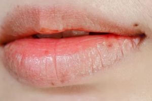Tak perlu beli lip scrub, ini cara mengatasi bibir pecah-pecah pakai 1 jenis kulit buah