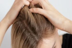 Rambut bebas ketombe dan lepek, begini trik membuat scrub kulit kepala pakai 1 bahan pemanis